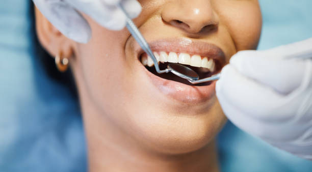 Best Emergency Dental Care for Broken or Chipped Teeth in Hoyt Lakes, MN